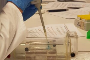 Beim Angebot "Epigenetische Veränderungen bei Colitis ulcerosa" vom life:labor lernen die Schülerinnen und Schüler die Gel-Elektrophorese kennen